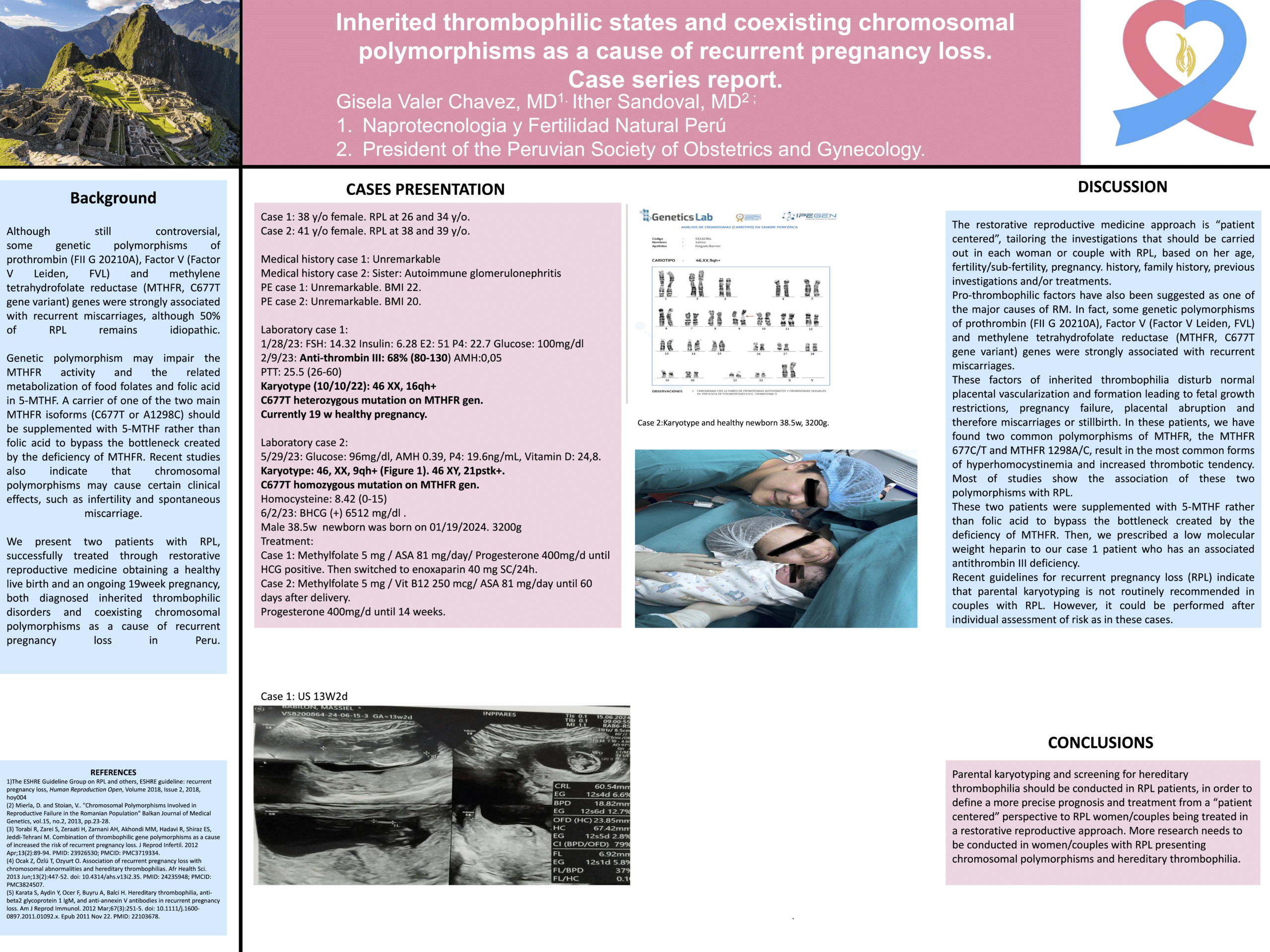 Restorative Reproductive Medicine as a treatment in RPL patients with inherited thrombophilic disorders and coexisting chromosomal polymorphisms in Peru Poster